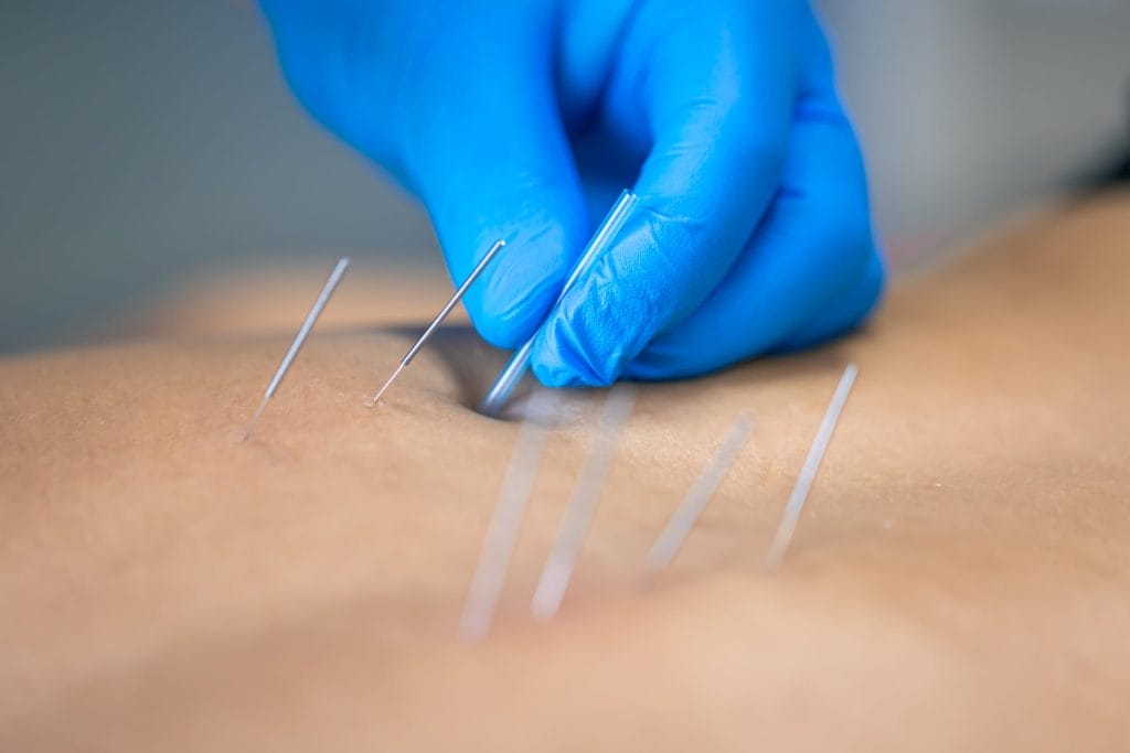 Acupuncture Medical Billing Services